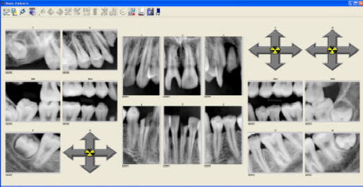 ProImage X-rays